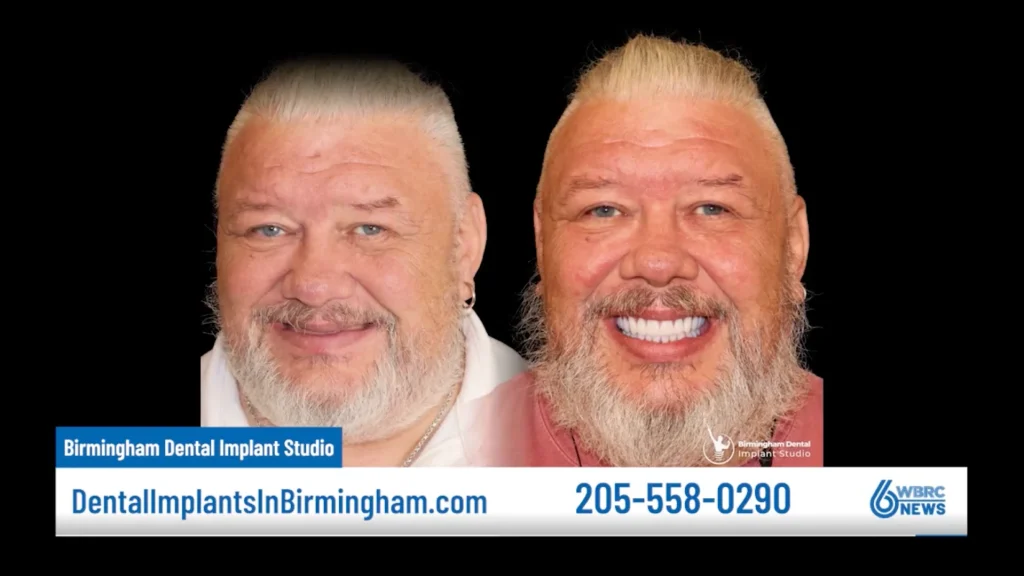 Dr. Laith Matalka from Birmingham Dental Implant Studio featured on Ask the Expert!